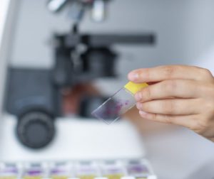 Read more about the article Certificare standarde de calitate ale laboratorului Pathoteam Diagnostic